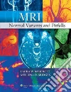 MRI Normal Variants and Pitfalls MRI Normal Variants and Pitfalls
